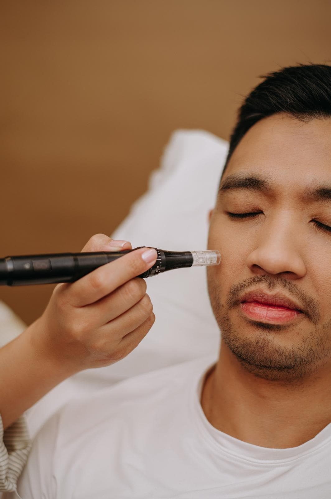 Basic Microneedling